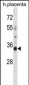 OR4K13 Antibody (N-term)